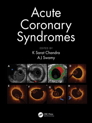 cover image of Acute Coronary Syndromes